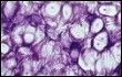 Chrząstka komórki macierzyste