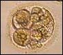 Embrionalne komórki macierzyste