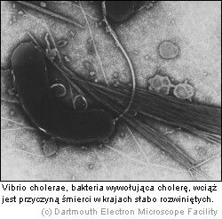 Cholera Vibrio cholerae